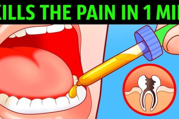 Broken Tooth Pain Relief