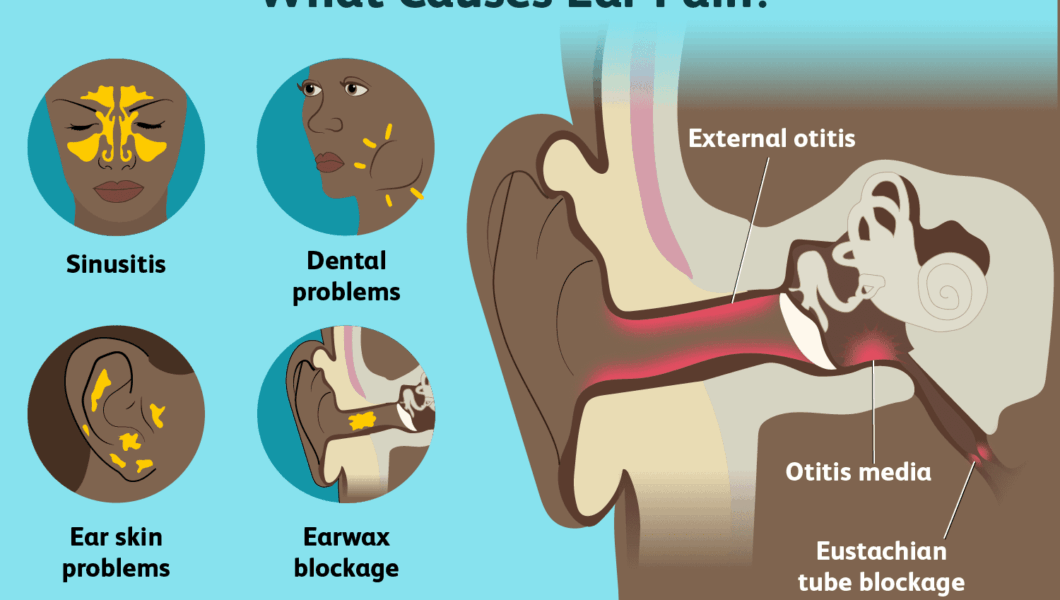 What Is Ear Pain Symptoms, Causes, Diagnosis