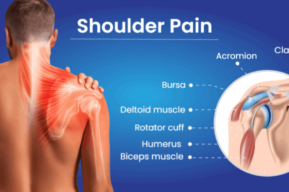 What is Shoulder Pain