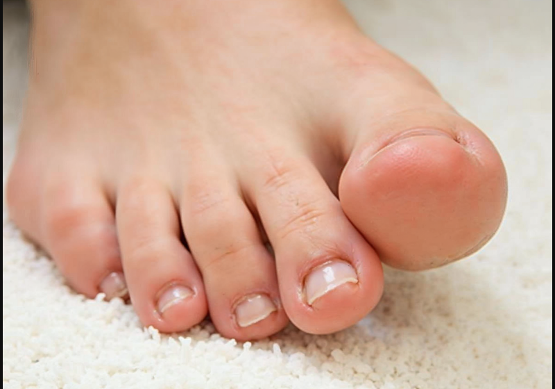 Toenail Health 101: How to Keep Your Nails Strong, Smooth, and Problem-Free Naturally