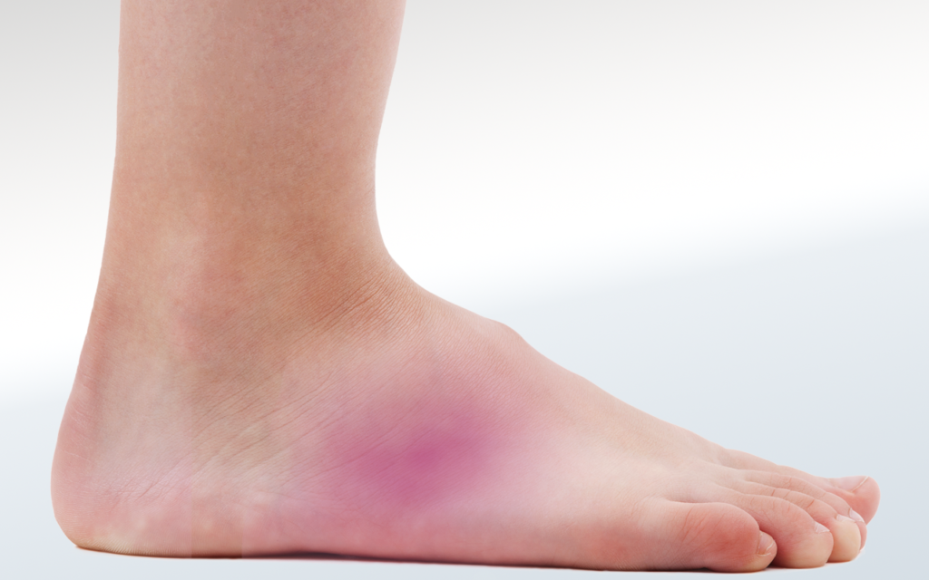Pain on Outside of Foot