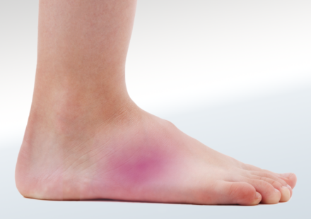Pain on Outside of Foot