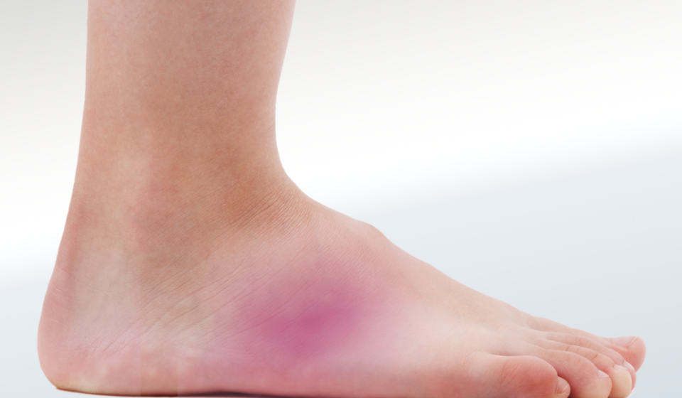 Pain on Outside of Foot